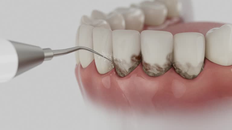 Trusted Dental Implants service in Aurora, TX - Dentist Open Now
